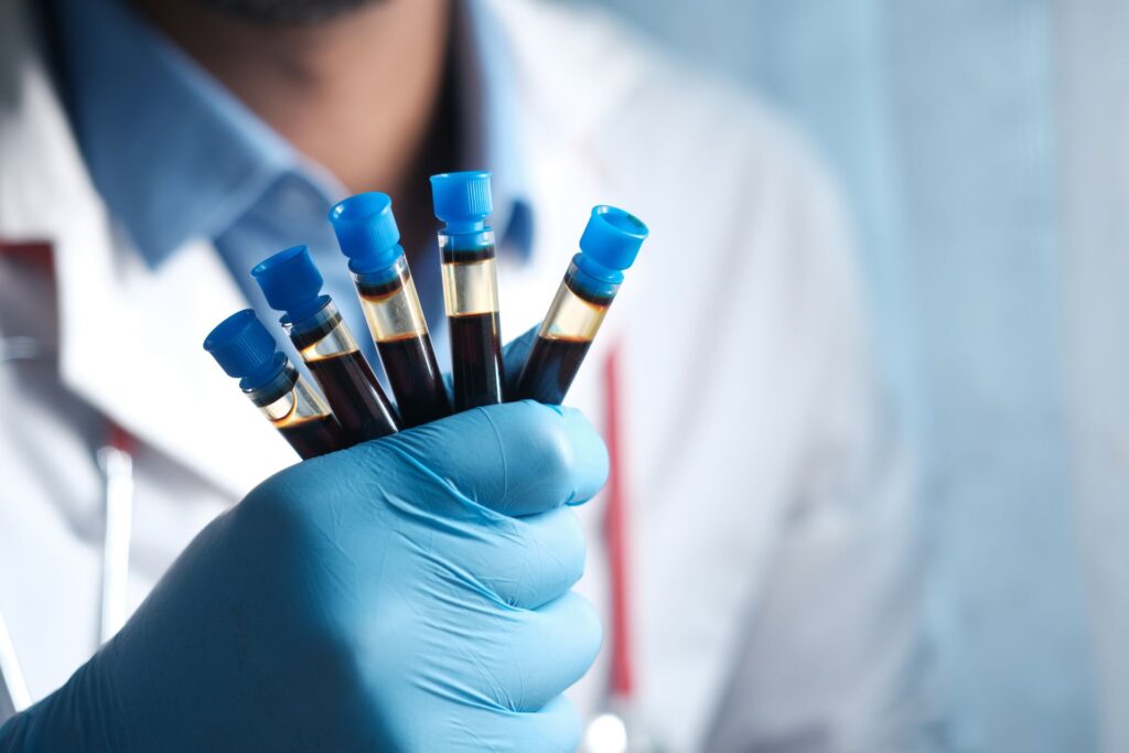 Relance post-cure (PCT) : clomifène, hCG et testostérone naturelle